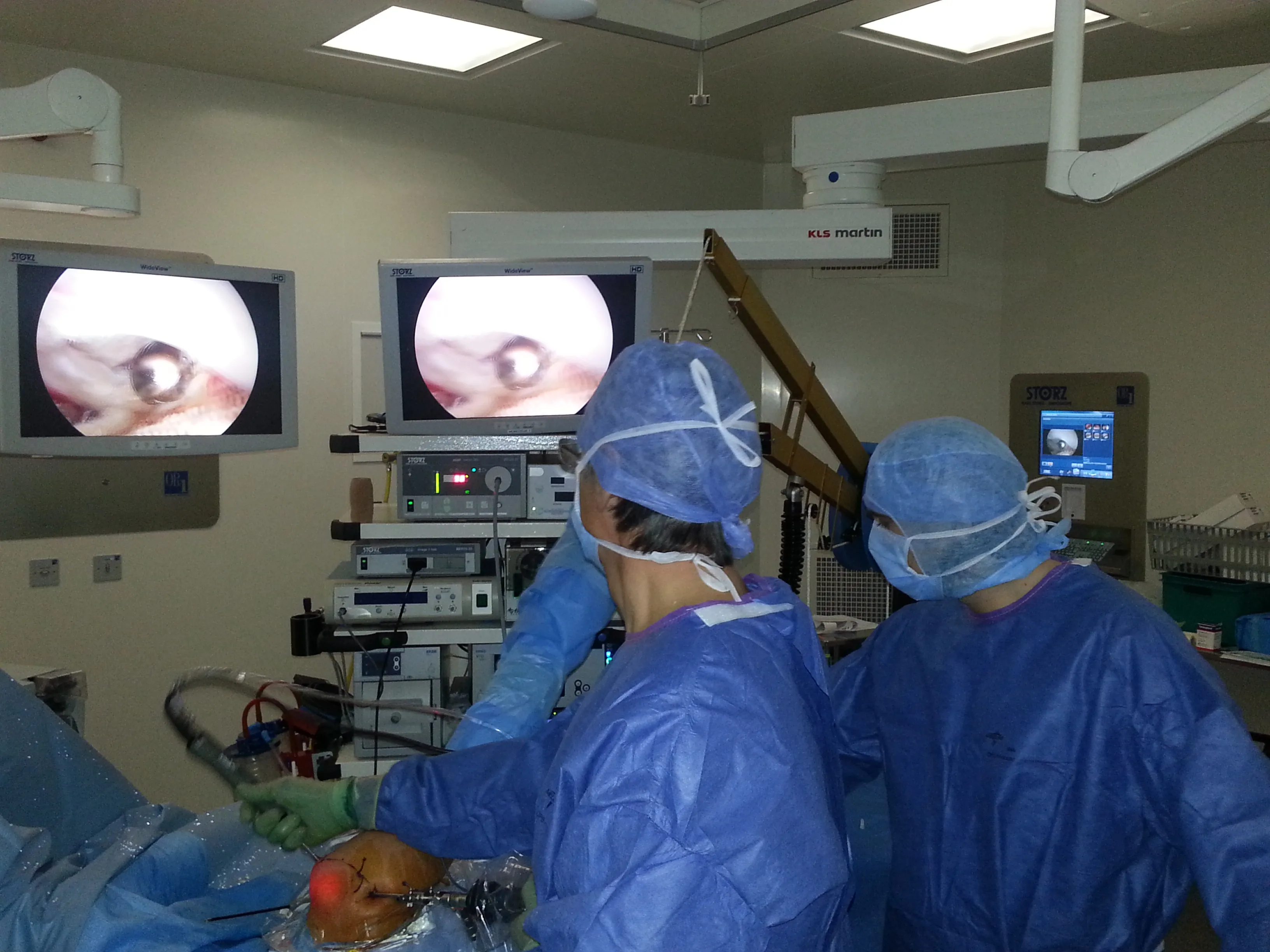 Chirurgie arthroscopique épaule