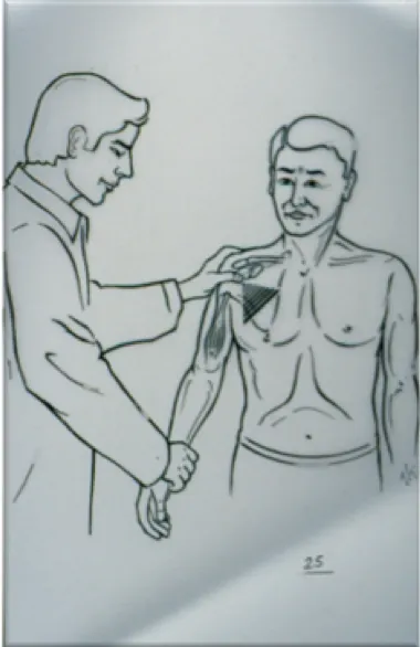 Douleurs épaule, traitements